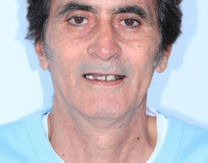 Caso real: antes del tratamiento